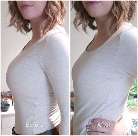 Breast Minimizer Bra - Enchant
